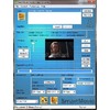 Скриншоты SmartMovie (Symbian) 4.15